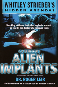 Casebook: Alien Implants: Alien Implants