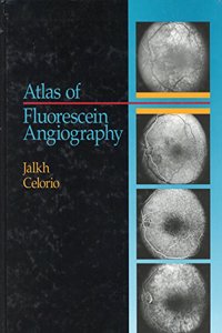 Atlas of Fluorescein Angiography