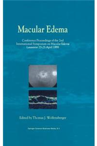 Macular Edema