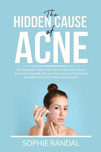 The Hidden Cause of Acne