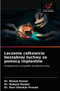 Leczenie calkowicie bezzębnej żuchwy za pomocą implantów