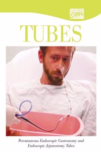 Percutaneous Endoscopic Gastronomy and Endoscopic Jejunostom Tubes (CD)