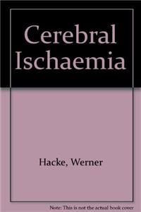 Cerebral Ischaemia