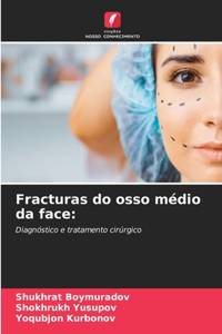 Fracturas do osso médio da face