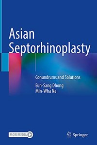 Asian Septorhinoplasty