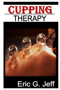 Cupping for Beginners