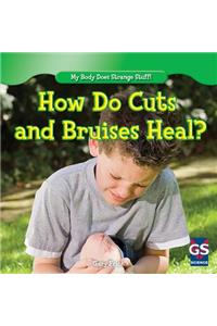 How Do Cuts and Bruises Heal?