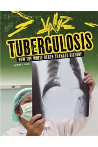 Tuberculosis