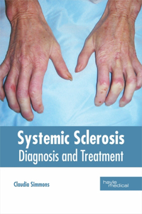 Systemic Sclerosis: Diagnosis and Treatment