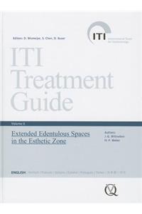 Iti Treatment Guide, Vol 6: Extended Edentulous Spaces in the Esthetic Zone