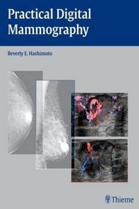 Practical Digital Mammography