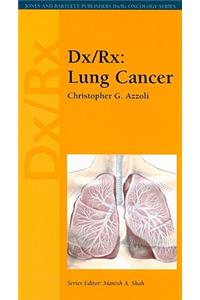DX/RX: Lung Cancer