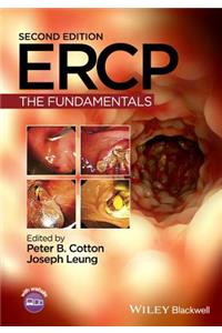 Ercp