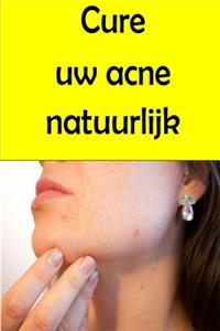 Cure uw acne natuurlijk