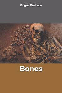 Bones