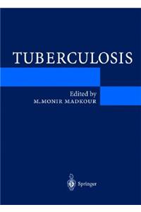 Tuberculosis