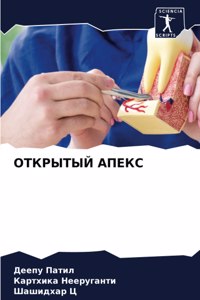 ОТКРЫТЫЙ АПЕКС