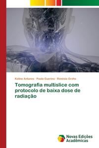 Tomografia multislice com protocolo de baixa dose de radiação