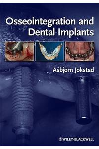 Osseointegration and Dental Implants