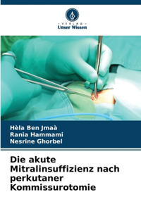 Die akute Mitralinsuffizienz nach perkutaner Kommissurotomie