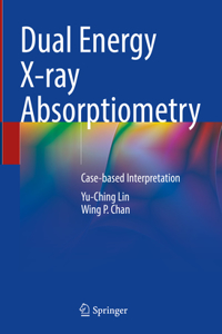 Dual Energy X-Ray Absorptiometry