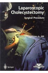 Laparoscopic Cholecystectomy - Surgical Procedure