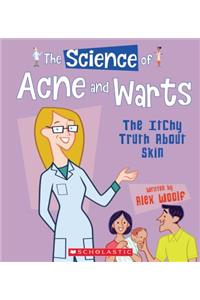 Science of Acne and Warts: The Itchy Truth about Skin (the Science of the Body)