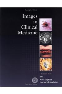 Images in Clinical Medicine: Selections from the New England Journal of Medicine