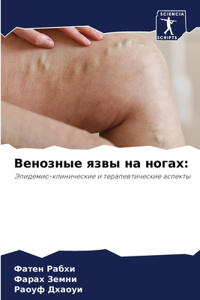 Венозные язвы на ногах