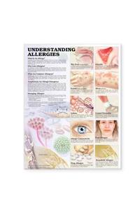 Understanding Allergies Anatomical Chart