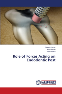 Role of Forces Acting on Endodontic Post