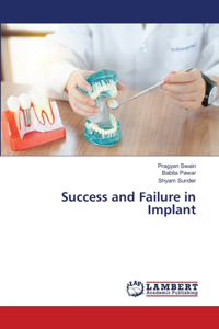 Success and Failure in Implant