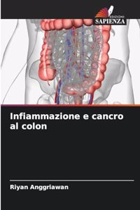 Infiammazione e cancro al colon