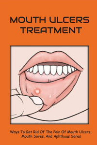 Mouth Ulcers Treatment