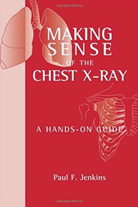 Making Sense of the Chest X-Ray: A Hands-On Guide