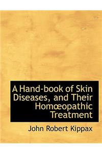 A Hand-Book of Skin Diseases, and Their Homa