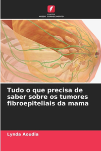 Tudo o que precisa de saber sobre os tumores fibroepiteliais da mama