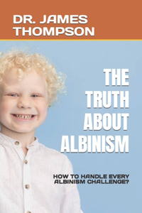 The Truth about Albinism