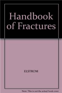 Handbook of Fractures