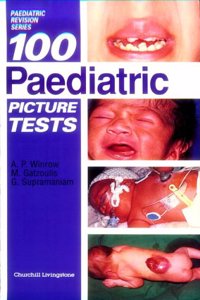 100 Paediatric Picture Tests (MRCPCH Study Guides)