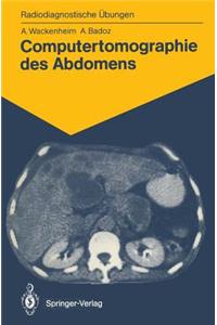 Computertomographie Des Abdomens