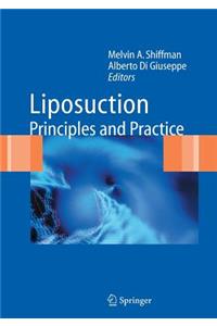 Liposuction: Principles and Practice