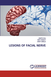 Lesions of Facial Nerve