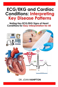 ECG/EKG and Cardiac Conditions