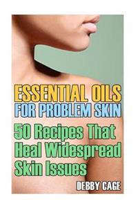 Essential Oils For Problem Skin