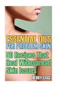 Essential Oils For Problem Skin: 50 Recipes That Heal Widespread Skin Issues