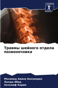 Травмы шейного отдела позвоночника