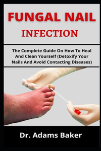 Fungal Nail Infection