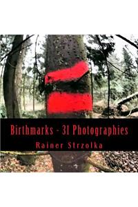 Birthmarks - 31 Photographies