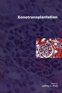 Xenotransplantation